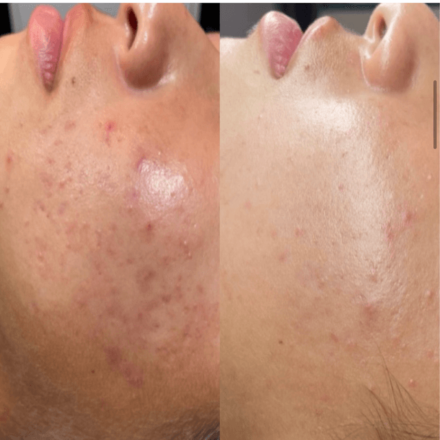 Major Fade Program at Skin Society Hawaii in Honolulu, HI